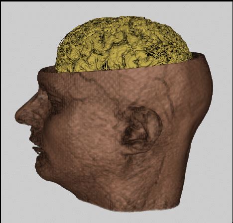 Image result for MRI Spatial Localization