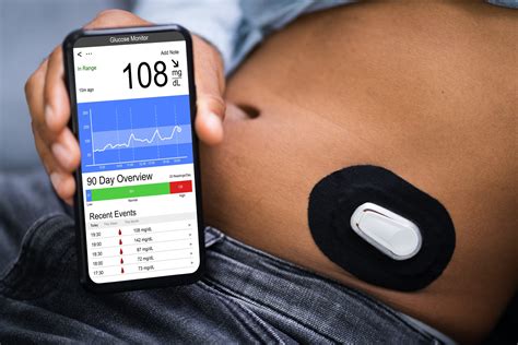 Image result for Dexcom G6 Monitoring System