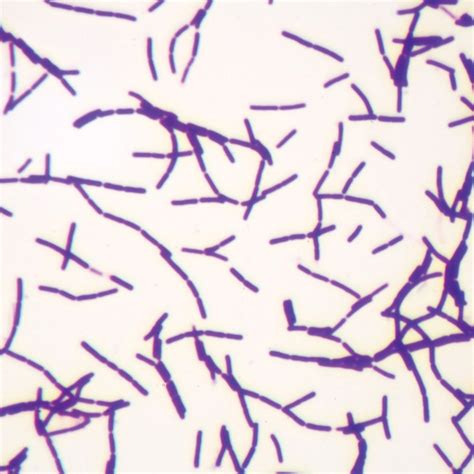 Bacteria Microscope Slides に対する画像結果