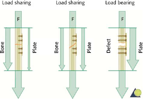 Image result for Distributed Load Force