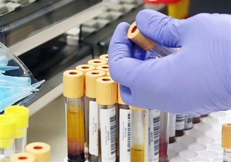 Image result for Positive in Drug Tests Unit Test