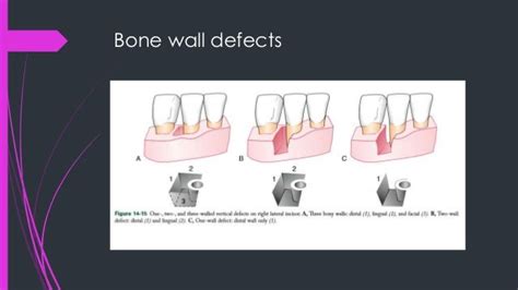 Image result for Abnormal Wall Defects Classification