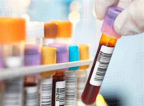 Image result for In Hospital Blood Lab Test