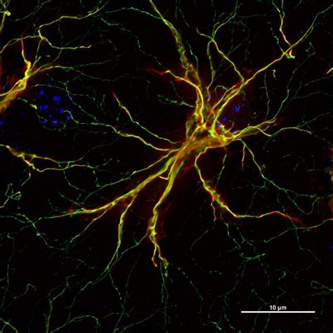 Image result for Light Microscope Protein