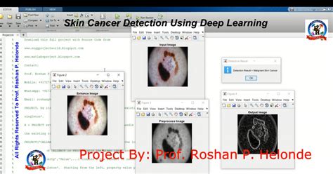 Image result for Skin Cancer Detection Using CNN