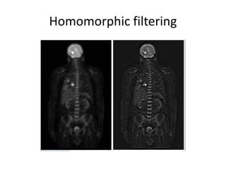 Image result for Homomorphic Filtering