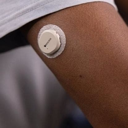 Image result for Apply Dexcom Sensor