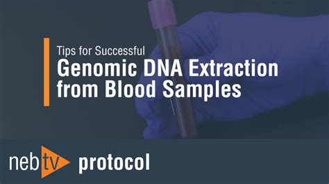DNA Extraction Method GIF に対する画像結果