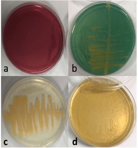Afbeeldingsresultaten voor Staph Aureus On MacConkey