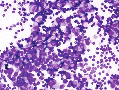 Diff Quick Stain Procedure に対する画像結果
