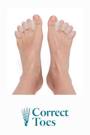 Image result for Positive Toe Alignment