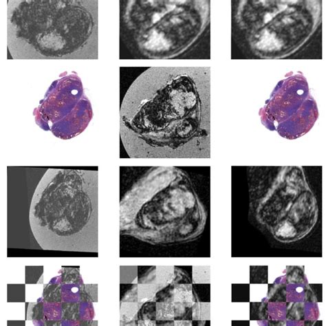 MRI Registration Python に対する画像結果