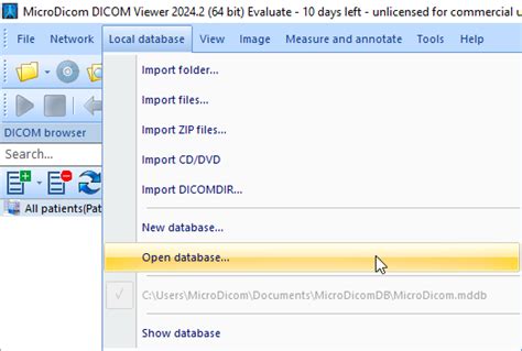 Afbeeldingsresultaten voor Database File Opener