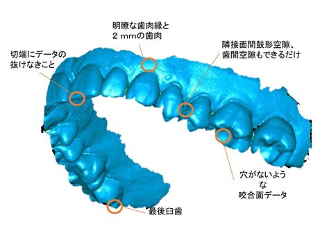 Image result for iOS Erkenner