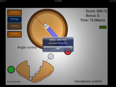 Image result for Eye Cataract Check App