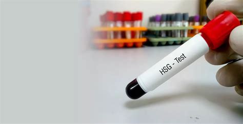 Afbeeldingsresultaten voor Testing Process Step by Step