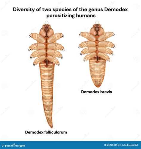 Demodex Mites On EyeLashes に対する画像結果