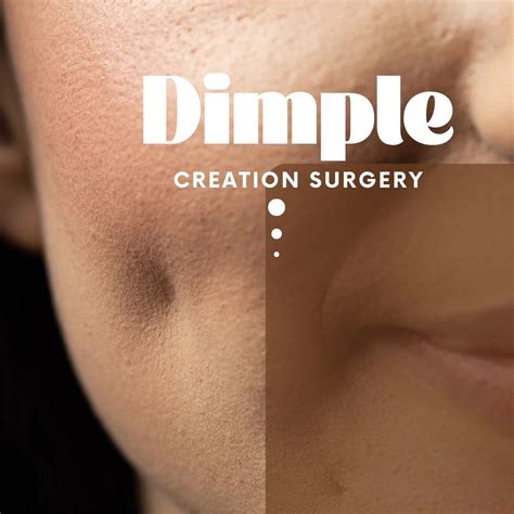 Dimple Procedure に対する画像結果