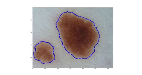 Image result for Get Contour From Images Python