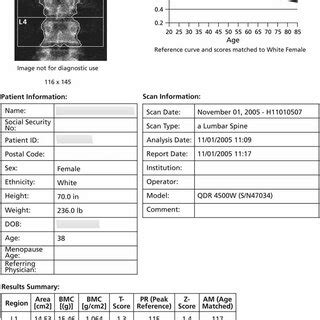 Image result for Scan De QR Code