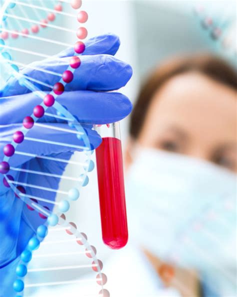 Image result for 5Ml Syringe with 19G Needle