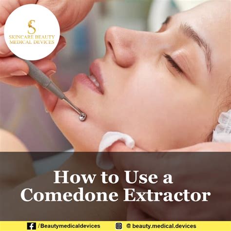 Image result for Comedone Extractor