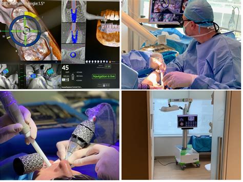 Image result for Guided Surgery