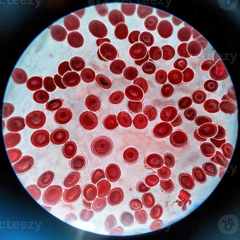 Normal Red Blood Cells Under Microscope-साठीचा प्रतिमा निकाल