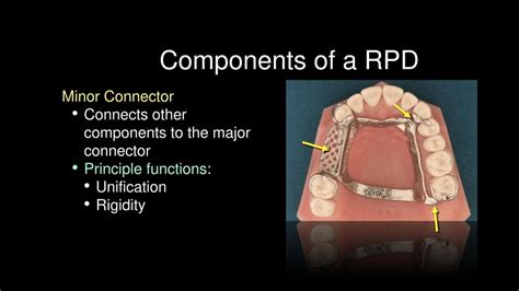 How to Load a RPD に対する画像結果