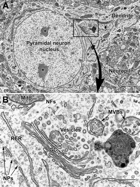 Image result for Neuron Under Electron Microscope