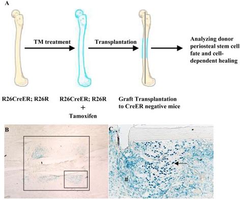 Afbeeldingsresultaten voor Creer Tarmoxifen
