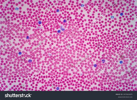 Image result for Blood Cell Using Light Microscope