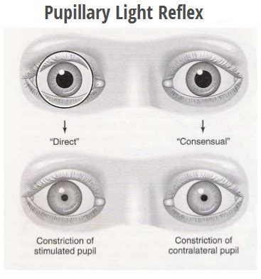 Pupillary Light Reflex Test に対する画像結果