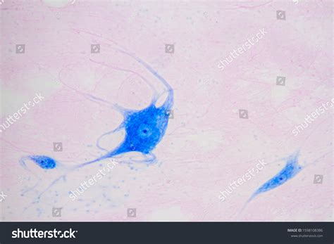 Image result for Giant Multipolar Neuron Microscope