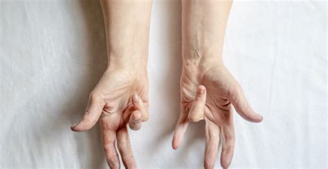 Toradh íomhá ar Digit Widget Finger