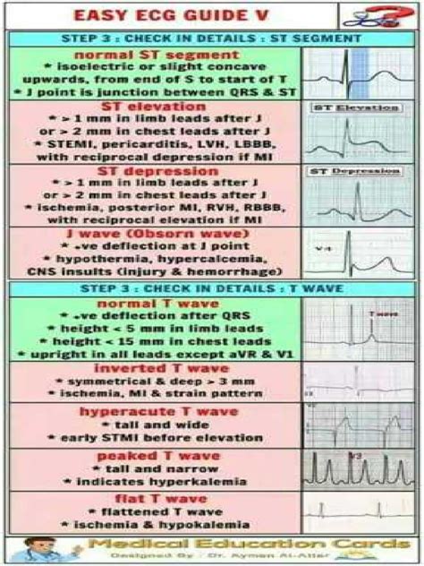 Easy ECG Guide に対する画像結果