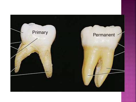 Image result for Permanent Tooth