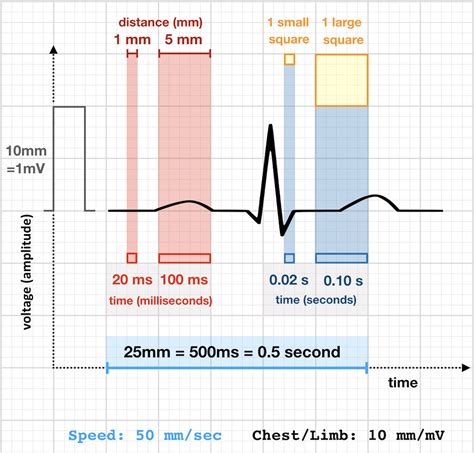 Image result for Normal EKG Measurement