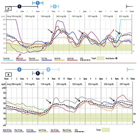 Toradh íomhá ar Compression Types of CGM Graphics