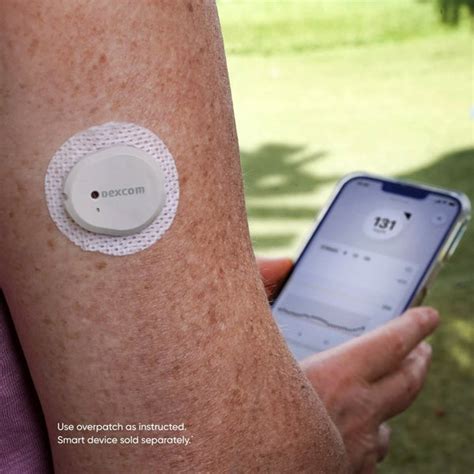 Dexcom Sensor On Arm માટે ઇમેજ પરિણામ