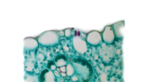 Image result for Guard Cell Structure Micrograph