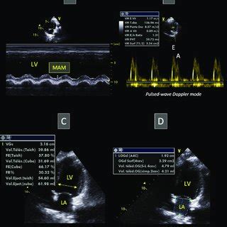 Apical 5 Chamber View に対する画像結果