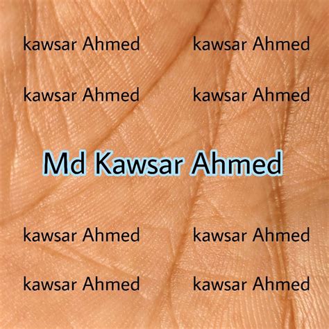 Image result for Degagement Totalisant 3Up