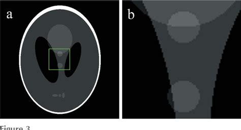Iteratively Corrected Delay and Sum Algorithm for Image Reconstruction に対する画像結果