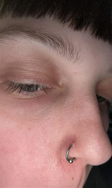 Afbeeldingsresultaten voor Bumpy Nose