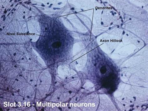 Image result for LAN LED Multipolar Neuron