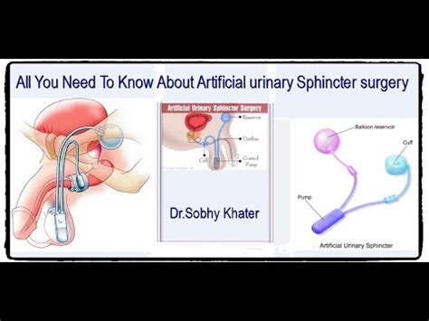 Image result for Ghost First Live Concert