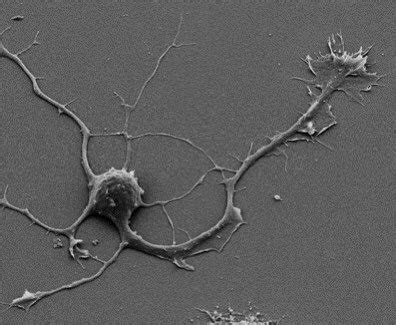 Image result for MS Neuron Microscope