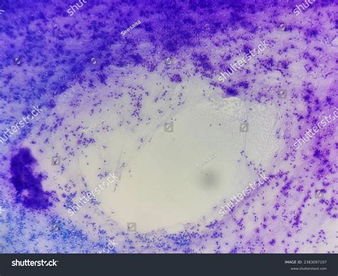 Diff Quick Stain Procedure に対する画像結果