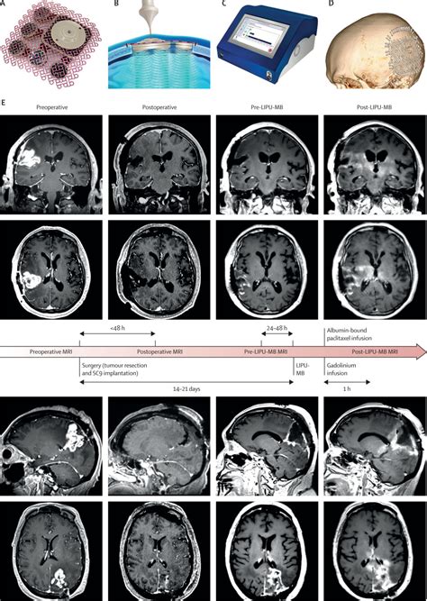 Toradh íomhá ar Progrming Course Thumbnail